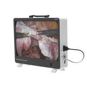 تمام-ان-ایک میڈیکل اینڈوسکوپ کیمرا سسٹم